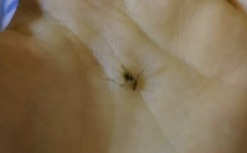 如何預防蚊子的叮咬