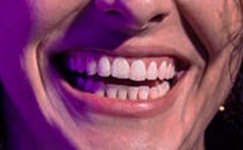 孕婦牙齦出血吃什么是最好
